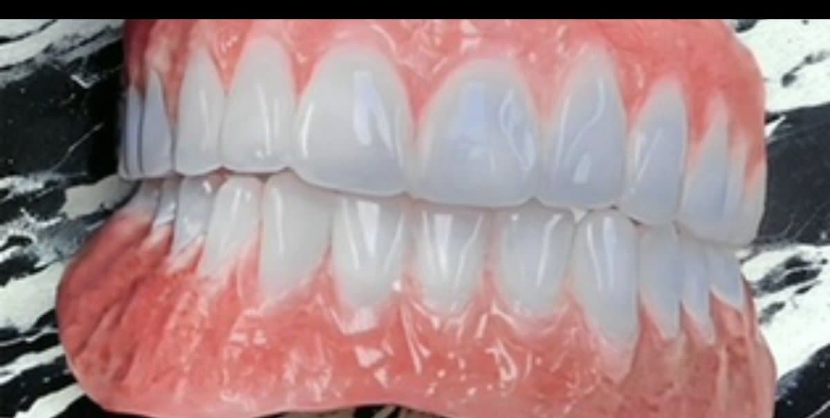 Full denture set