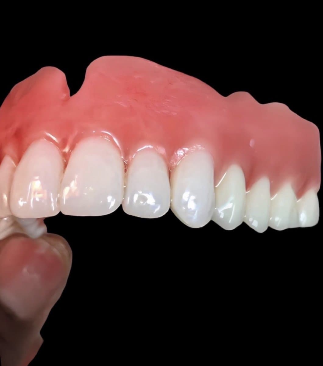 Full upper denture